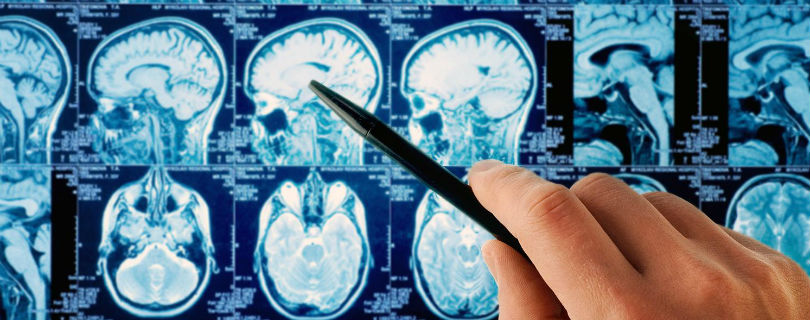 Итальянский суд признал, что мобильный телефон вызвал опухоль мозга у служащего
